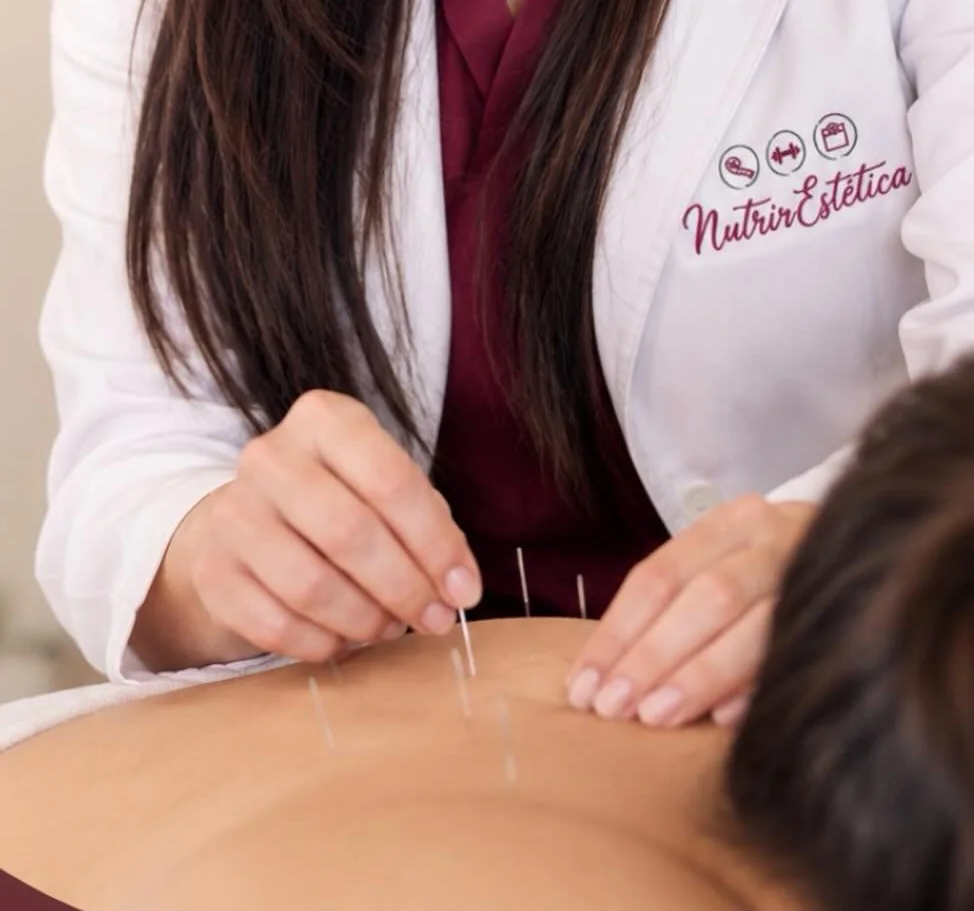 Mãos da fisioterapeuta aplicando agulhas de acupuntura nas costas de um paciente